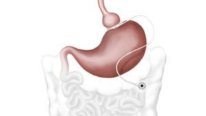 Illustration of stomach
