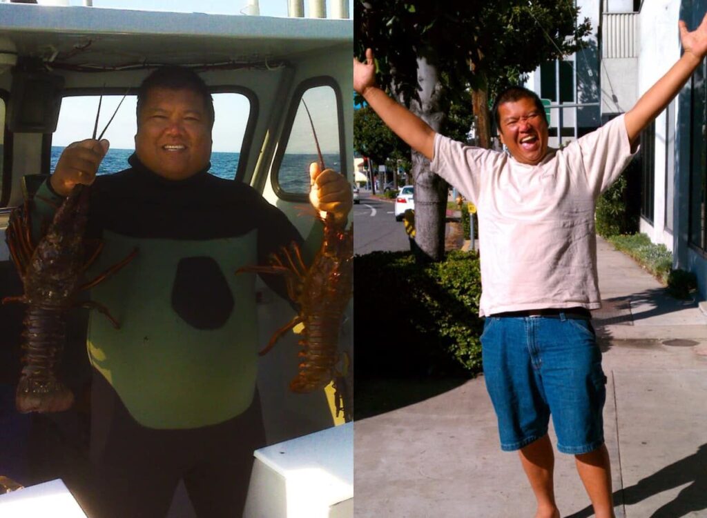 Before and After Bariatric Surgery