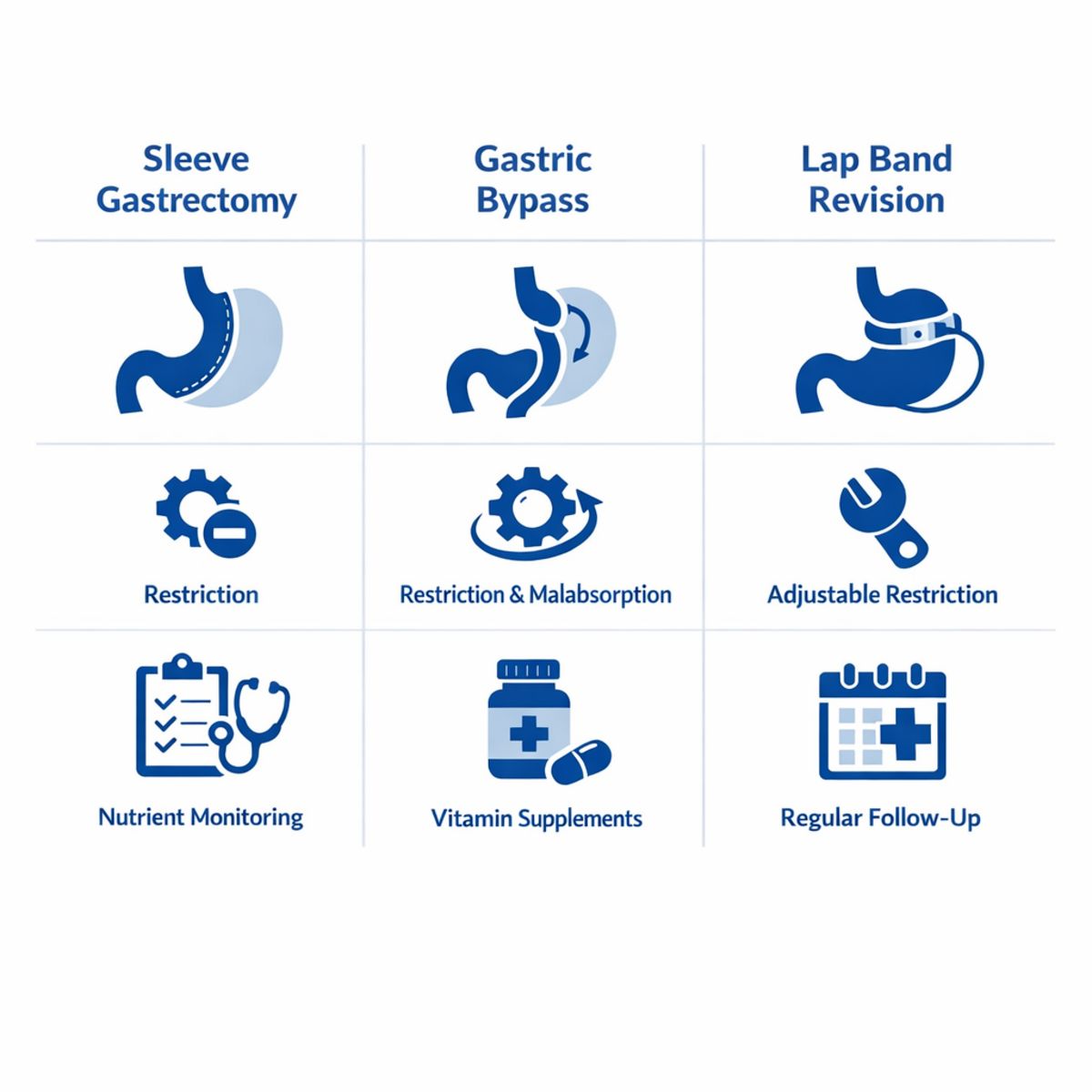 Infographic comparing sleeve gastrectomy, gastric bypass, and lap band revision with anatomy and pathway icons.